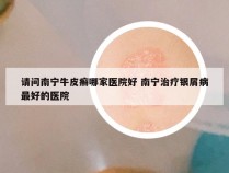 请问南宁牛皮癣哪家医院好 南宁治疗银屑病最好的医院