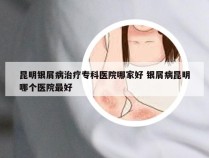 昆明银屑病治疗专科医院哪家好 银屑病昆明哪个医院最好