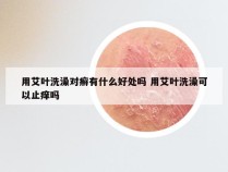 用艾叶洗澡对癣有什么好处吗 用艾叶洗澡可以止痒吗