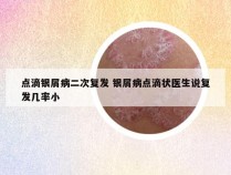 点滴银屑病二次复发 银屑病点滴状医生说复发几率小