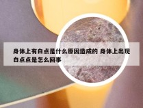 身体上有白点是什么原因造成的 身体上出现白点点是怎么回事