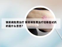 银屑病免费治疗 银屑病免费治疗招募是试药的是什么意思?