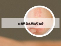 白癜风怎么预防可治疗