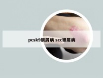 pcsk9银屑病 scc银屑病