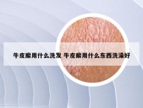 牛皮廨用什么洗发 牛皮廨用什么东西洗澡好