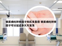 银屑病吃转移因子和匹多莫德 银屑病吃转移因子可以延迟多久不复发