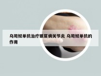 乌司奴单抗治疗银屑病关节炎 乌司奴单抗的作用