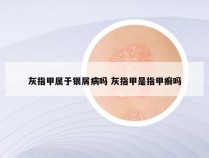 灰指甲属于银屑病吗 灰指甲是指甲癣吗