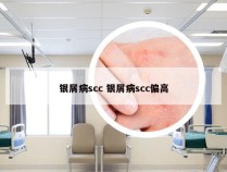 银屑病scc 银屑病scc偏高