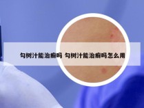 勾树汁能治癣吗 勾树汁能治癣吗怎么用