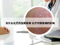 为什么化疗药治银屑病 化疗对银屑病的影响