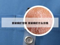 紫椒癣酊官网 紫椒癣酊什么价格