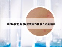 啊维a胶囊 阿维a胶囊副作用多长时间消失