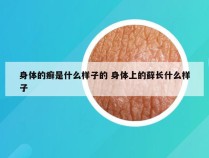 身体的癣是什么样子的 身体上的藓长什么样子