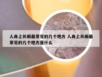 人身上长癣最常见的几个地方 人身上长癣最常见的几个地方是什么