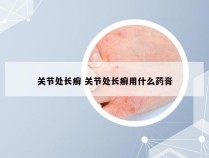 关节处长癣 关节处长癣用什么药膏