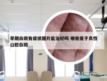 早期白斑有症状图片能治好吗 哪些属于良性口腔白斑