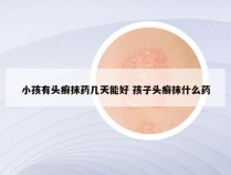 小孩有头癣抹药几天能好 孩子头癣抹什么药