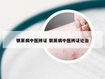 银屑病中医辨证 银屑病中医辨证论治