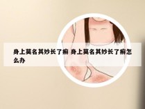 身上莫名其妙长了癣 身上莫名其妙长了癣怎么办