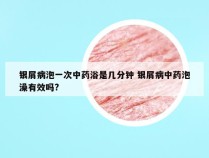 银屑病泡一次中药浴是几分钟 银屑病中药泡澡有效吗?