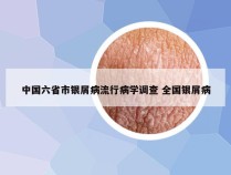 中国六省市银屑病流行病学调查 全国银屑病