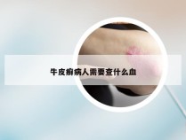 牛皮癣病人需要查什么血