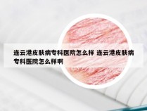 连云港皮肤病专科医院怎么样 连云港皮肤病专科医院怎么样啊