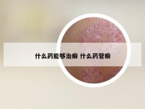 什么药能够治癣 什么药管癣