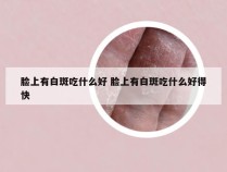 脸上有白斑吃什么好 脸上有白斑吃什么好得快