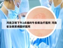 河南卫视下午2点播的牛皮癣治疗医院 河南省治银屑病最好医院