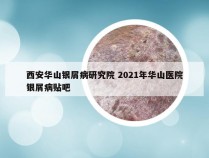 西安华山银屑病研究院 2021年华山医院银屑病贴吧