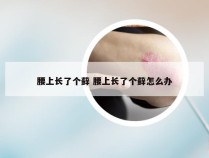 腰上长了个藓 腰上长了个藓怎么办