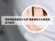 银屑病免疫差吃什么钙 银屑病吃什么提高免疫力的药