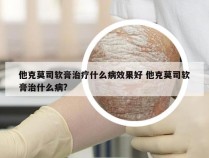 他克莫司软膏治疗什么病效果好 他克莫司软膏治什么病?