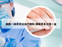 癣痒一抹灵可以治疗脚吗 癣痒灵多少钱一盒