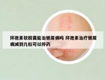 环孢素软胶囊能治银屑病吗 环孢素治疗银屑病减到几粒可以停药