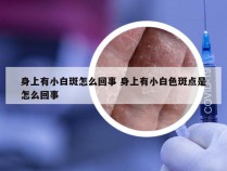 身上有小白斑怎么回事 身上有小白色斑点是怎么回事