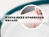 每次吃牛肉,藓就复发 吃牛肉皮肤为什么会痒用什么药好