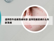 遗传性牛皮癣发病年龄 遗传性糖尿病什么年龄发病