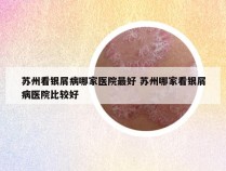 苏州看银屑病哪家医院最好 苏州哪家看银屑病医院比较好