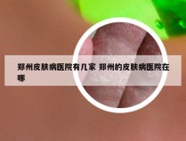 郑州皮肤病医院有几家 郑州的皮肤病医院在哪