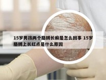 15岁男孩两个胳膊长癣是怎么回事 15岁胳膊上长红点是什么原因