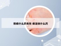 擦癣什么药有效 癣涂抹什么药