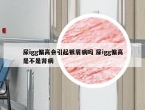 尿igg偏高会引起银屑病吗 尿igg偏高是不是肾病