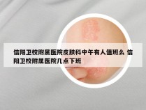 信阳卫校附属医院皮肤科中午有人值班么 信阳卫校附属医院几点下班