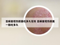 百癣夏塔热胶囊吃多久见效 百癣夏塔热胶囊一般吃多久