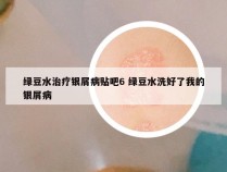 绿豆水治疗银屑病贴吧6 绿豆水洗好了我的银屑病