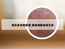 维生素和银屑病 银屑病服用维生素