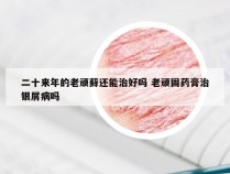 二十来年的老顽藓还能治好吗 老顽固药膏治银屑病吗